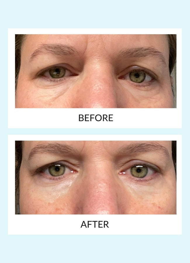 Night eye Beaute Eyelid Roller 6個セット Night eye Beaute Eyelid Roller 6個セット Night eye Beaute